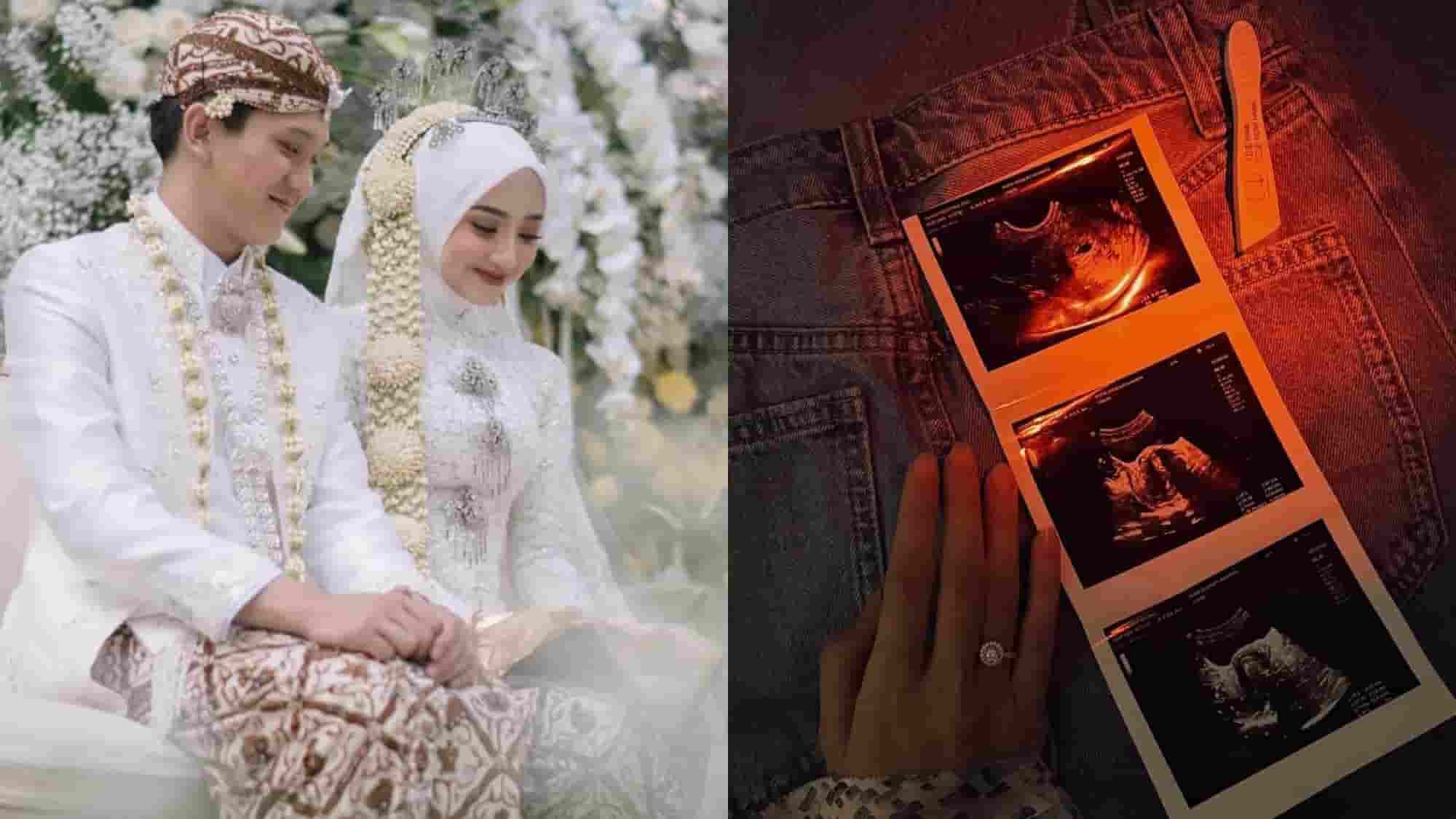 Ansellma Putri Hamil, Warganet Heboh Lihat Unggahan Foto USG di Instagram